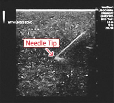 needle tip image